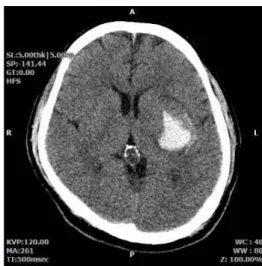 Fig. 1 The brain CT image of the patient.