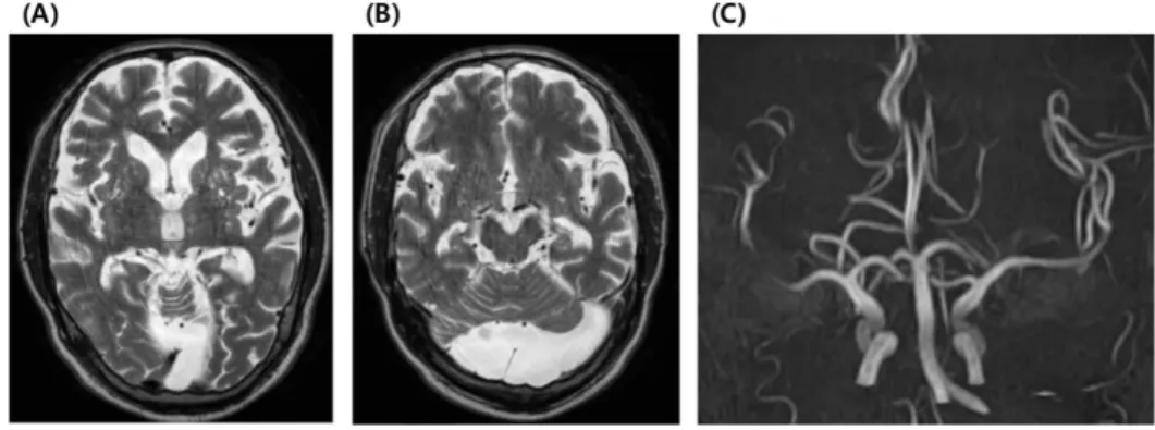 Fig. 1. Brain images of patient.