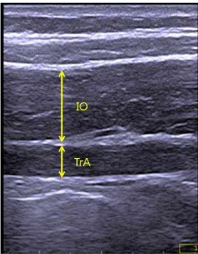 Fig  2.  Ultrasound  device  for  diagnosis  and  probe  shape