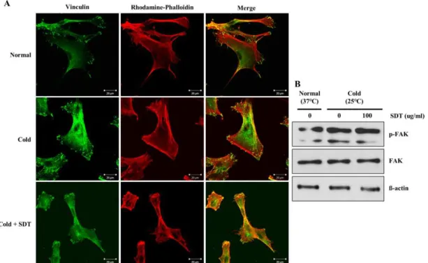 Fig. 5. Inhibitory effect of SDT on cold-induced formation of stress fiber and focal adhesion complex in HDMEC.