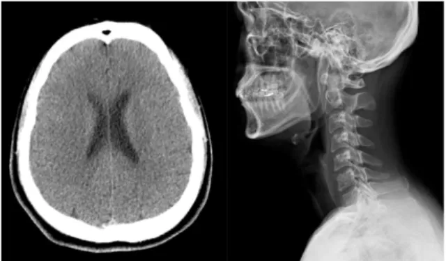 Fig. 1. Brain CT and C-SPINE X-ray of case 1.