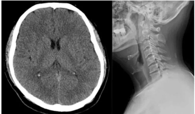 Fig. 2. Brain CT and C-SPINE X-ray of case 2.
