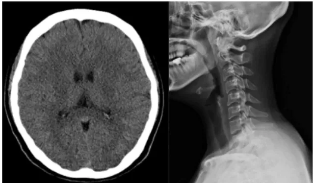 Fig. 3. Brain CT and C-SPINE X-ray of case 3.
