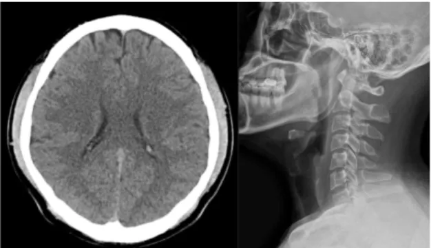 Fig. 5. Brain CT and C-SPINE X-ray of case 5.
