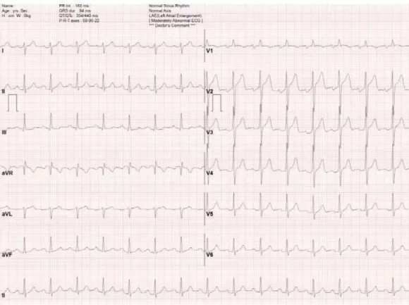 Fig. 1. 2019-10-10 EKG.
