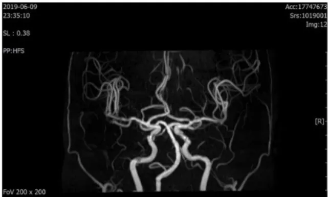 Fig. 1. Brain MRA result (2019.6.9.).