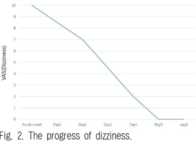 Fig. 2. The progress of dizziness.