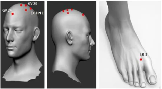 Fig. 2. Frequency distribution of acupuncture points on MCI.