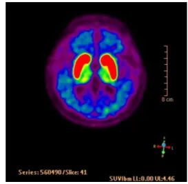 Fig. 3. PET (positron emission tomography; sagittal view)