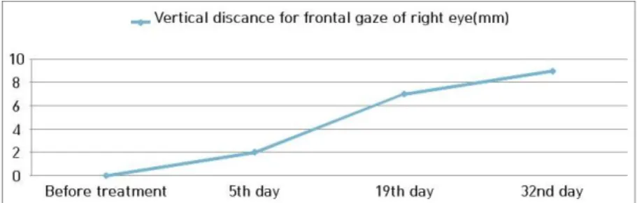 Fig. 3. Change of vertical distance for frontal gaze of right eye.