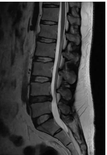 Fig. 1. L-SPINE MRI.