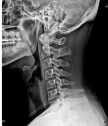 Fig. 1. Brain CT of case 1.