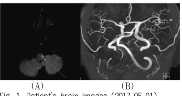 Fig. 1. Patient’s brain images (2017-05-01).