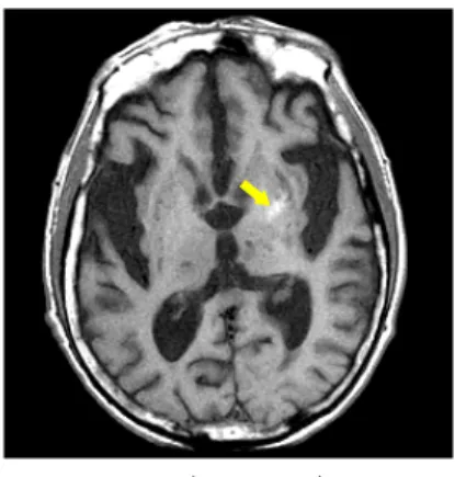 Fig. 2. Brain MRI T1 (2019.04.23).