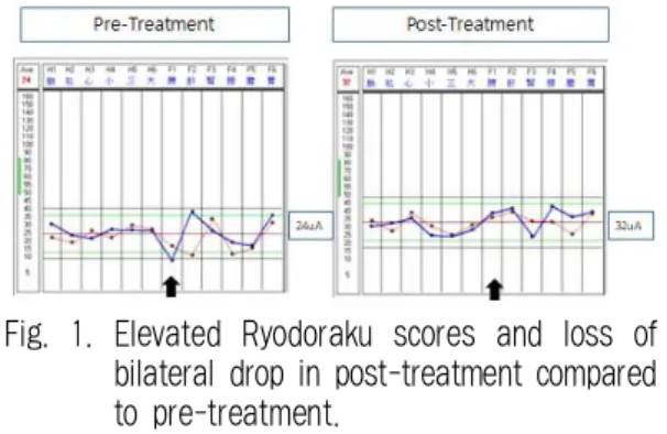 Table 1. Data of Symptom Score, Parameters of Ryodoraku, Electrogastrography and Bowel Sound between Pre- and Post-treatment