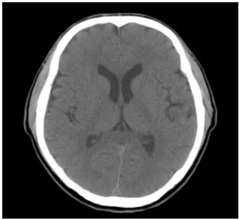 Fig. 1. Brain CT (non-enhance).