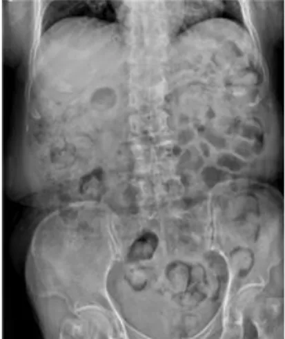 Fig. 1. Adbomen X-ray (X.11.27.).