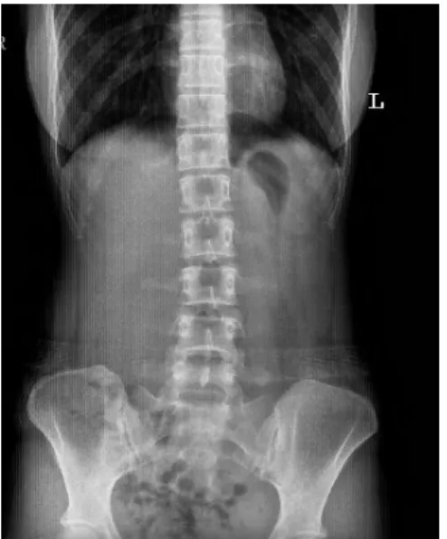 Fig. 1. The image of abdominal X-ray.