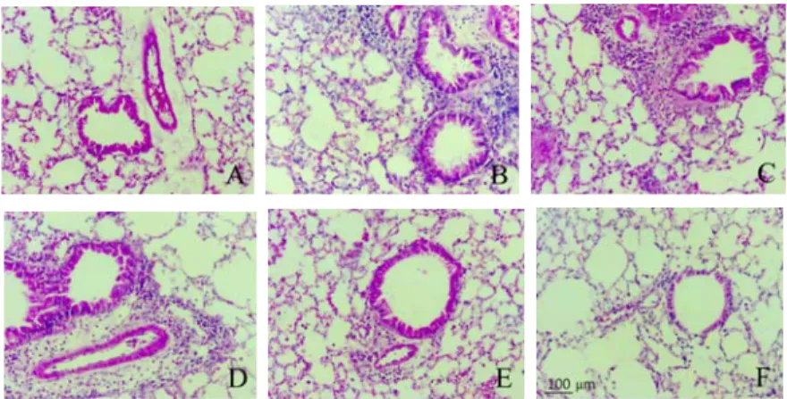 Fig. 4. Effects of HMT on histopathological changes of the lung tissue in asthmatic mice.