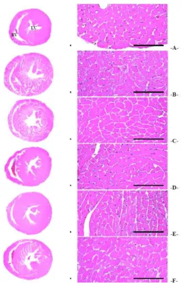 Fig. 4. The representative general histological images of heart, taken from sham or TAC operated mice.