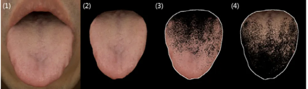 Fig. 1. Illustrations show (1) the original tongue image, (2) segmented tongue region, (3) tongue substance  area, and (4) tongue coating area.
