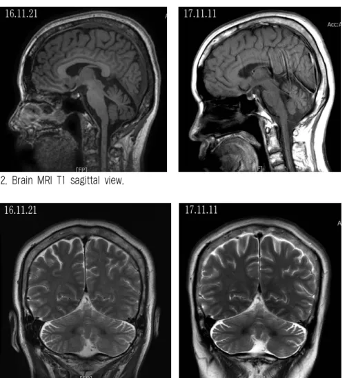 Fig. 2. Brain MRI T1 sagittal view.