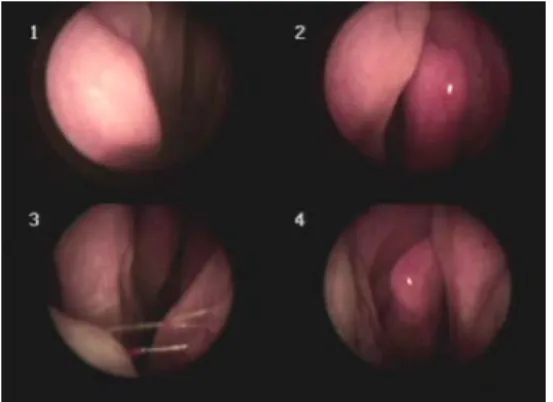 Fig. 1. 2018.3.7. chest X-ray.