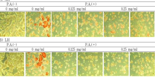 Fig. 4. The effect of AH and LH on lipid accumulation of HepG2 cells by oil red O stain.