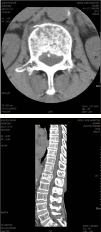 Fig. 2. L-SPINE MRI.