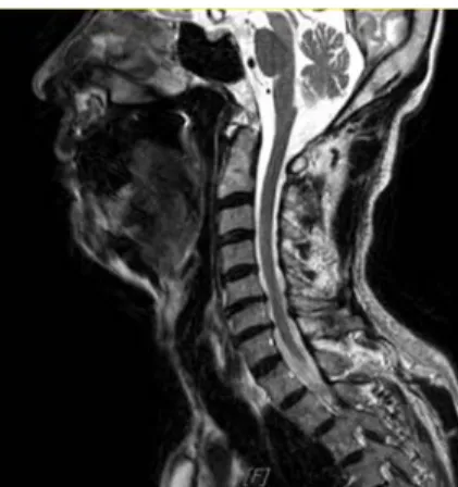 Fig. 3. C-SPINE MRI.