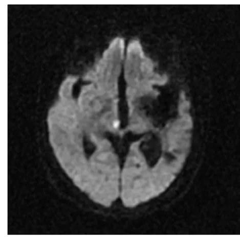 Fig. 1. Brain magnetic resonance imaging of patient  (2017.09.04)