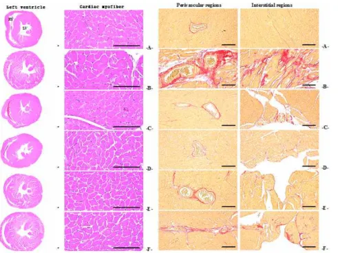 Fig. 3. The typical general histological images of heart and collagen stained histological images of left ventricle, taken from sham or TAC operated mice.