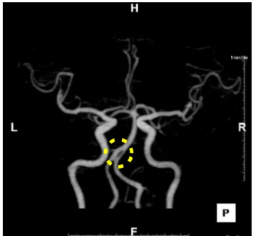 Fig. 3. 2016.08.30 Computed tomography angiography.
