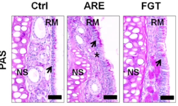 Fig. 2. The alleviation of AR induced respiratory  epithelial damages by HTD using Douchi  (PAS).
