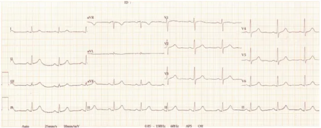 Fig. 1. Electrocardiogram of patient 1.
