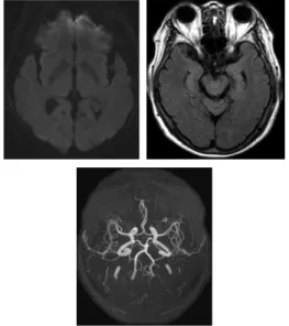 Fig. 1. Brain MRI &amp; MRA.