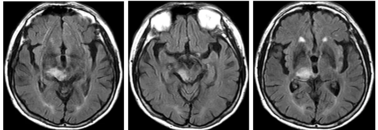 Fig. 1. Brain MRI image (2016.12.14).