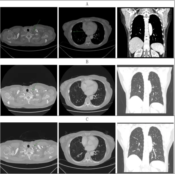 Fig. 1. Comparison of chest computed tomography.