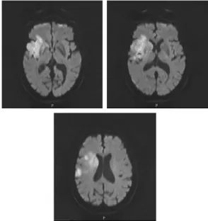 Fig. 1. Brain MRI image (2016.06.15).