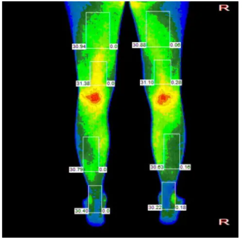Fig. 3. DITI back legs view.  3) 임상병리검사(2014년 10월 23일)   (1) MCH 33.60   (2) Glucose(FBS) 66.00 10