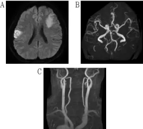 Fig. 1. The Brain imaging scans of the patient.