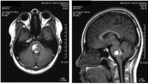 Fig. 1. Brain magnetic resonance imaging pictures of  the case.
