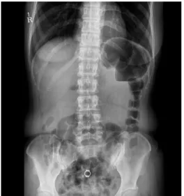 Fig. 1. The image of the abdominal X-ray.