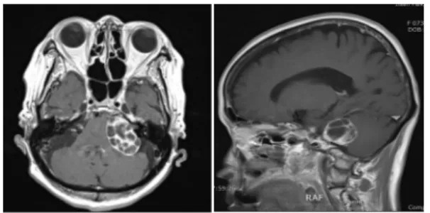Fig. 1. Brain MRI (2016.05.26).