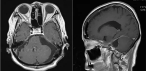Fig. 2. Brain MRI (2016.05.28).