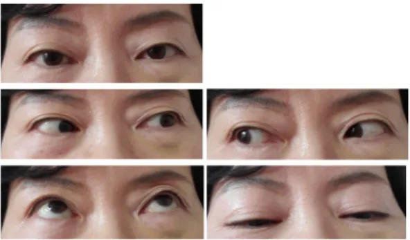 Fig. 3. Length of eyeball movement.