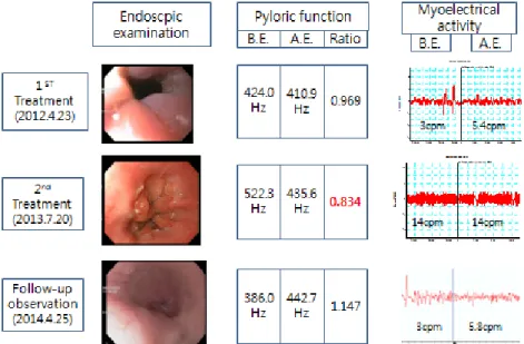 Fig. 1. Endoscopic finding, pyloric function, and gastric myoelectrical activity of this patient were presented.