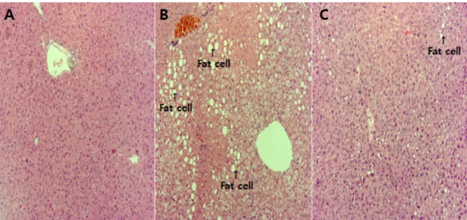 Fig. 17. Standard hematoxylin-eosin staining of liver from db/db mice. 