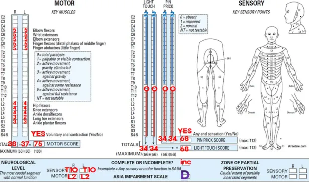 Fig. 1. American spinal cord injury association [15.11.1 checked].