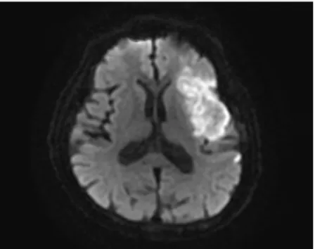 Fig. 2. Brain MRA (9/07).